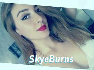 SkyeBurns