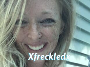 Xfreckledx
